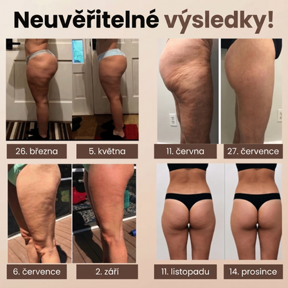 3D Legíny proti celulitidě